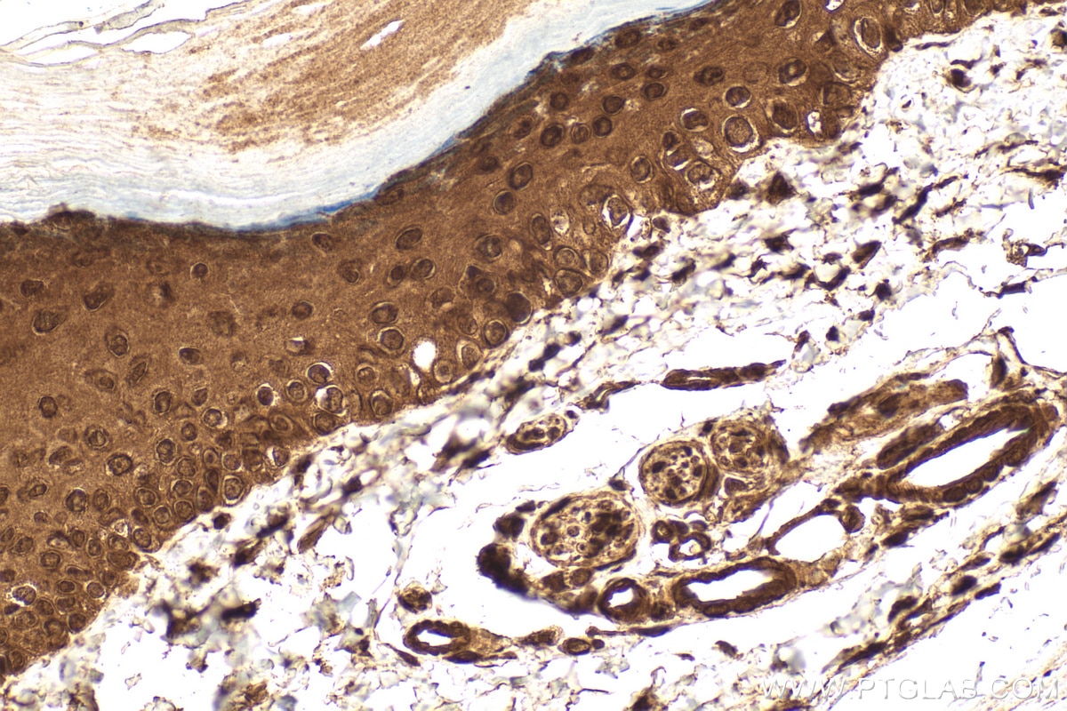 Immunohistochemistry (IHC) staining of mouse skin tissue using CFDP1 Polyclonal antibody (26636-1-AP)