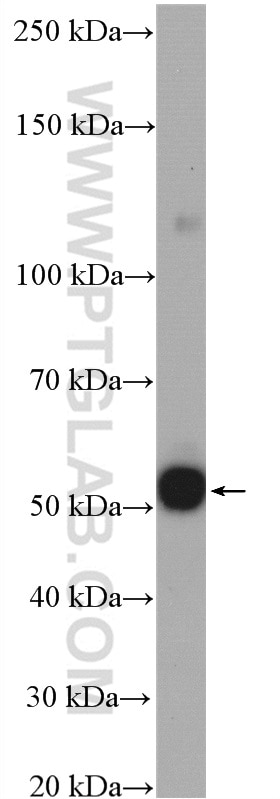 Western Blot (WB) analysis of K-562 cells using CFDP1 Polyclonal antibody (26636-1-AP)