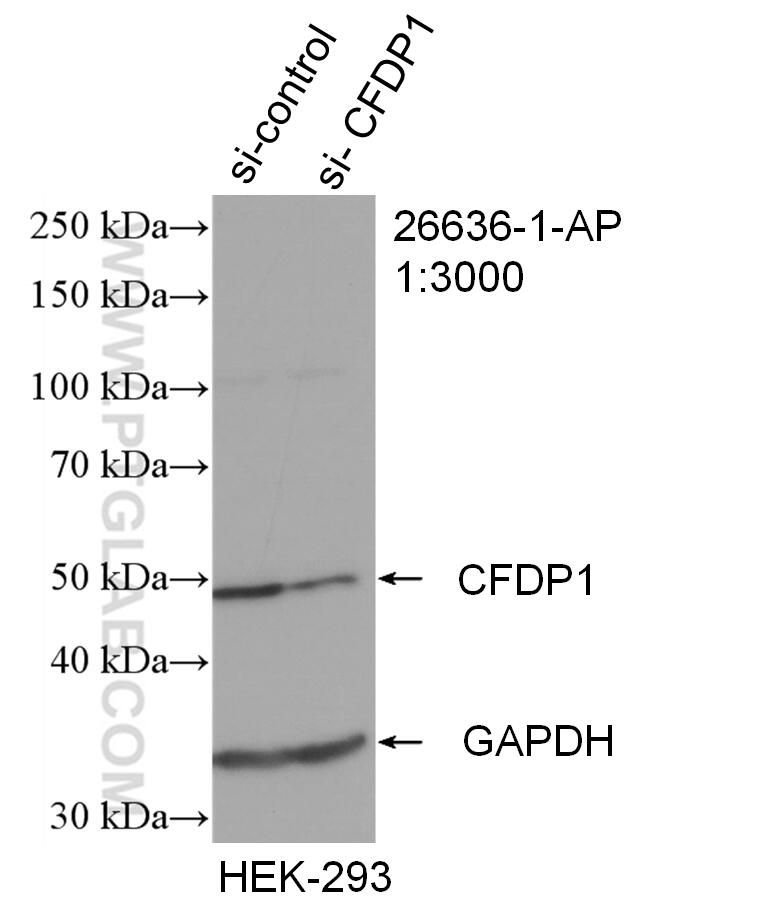 Western Blot (WB) analysis of HEK-293 cells using CFDP1 Polyclonal antibody (26636-1-AP)