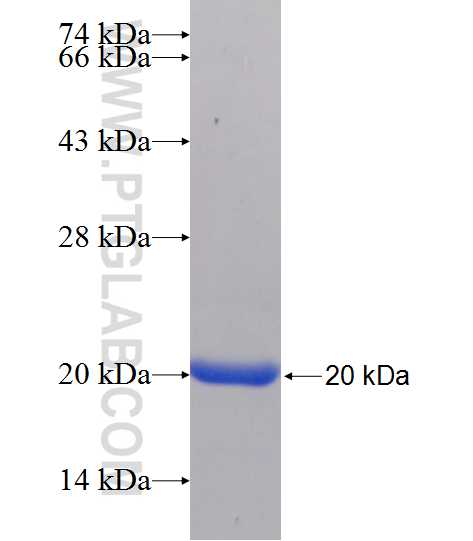 CFDP1 fusion protein Ag24418 SDS-PAGE