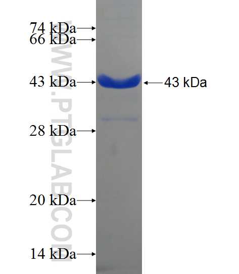 CFDP1 fusion protein Ag24425 SDS-PAGE