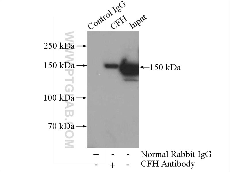 Immunoprecipitation (IP) experiment of human plasma using Complement factor H Polyclonal antibody (12748-1-AP)