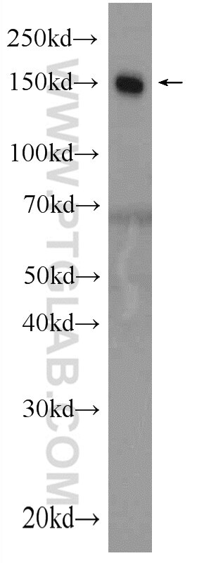 WB analysis of human blood using 12748-1-AP