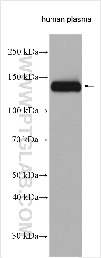 Western Blot (WB) analysis of various lysates using Complement factor H Polyclonal antibody (12748-1-AP)