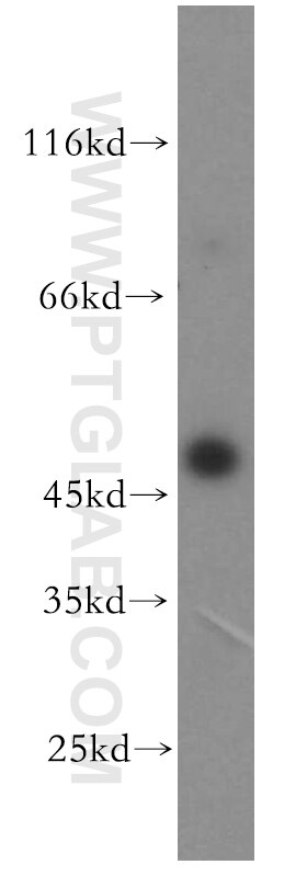 Complement factor H