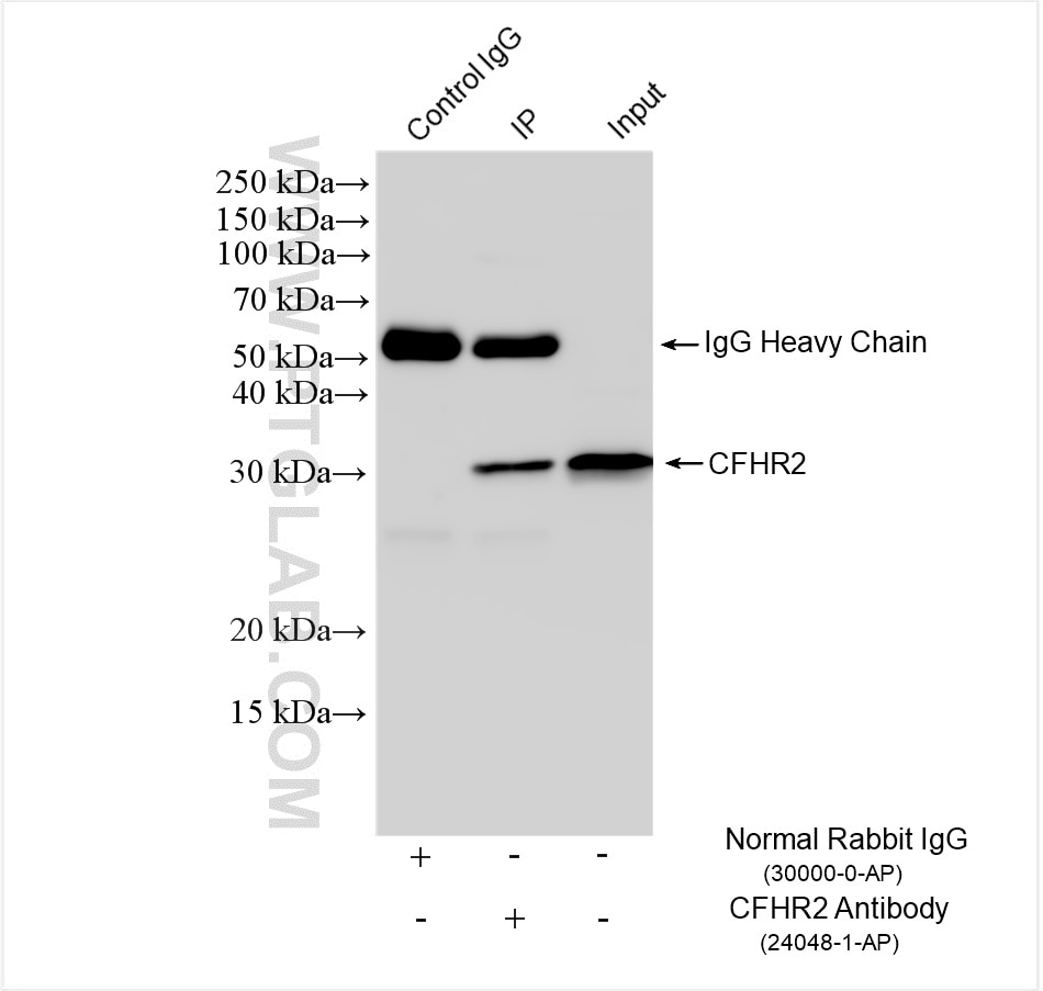 Immunoprecipitation (IP) experiment of HepG2 cells using CFHR2 Polyclonal antibody (24048-1-AP)