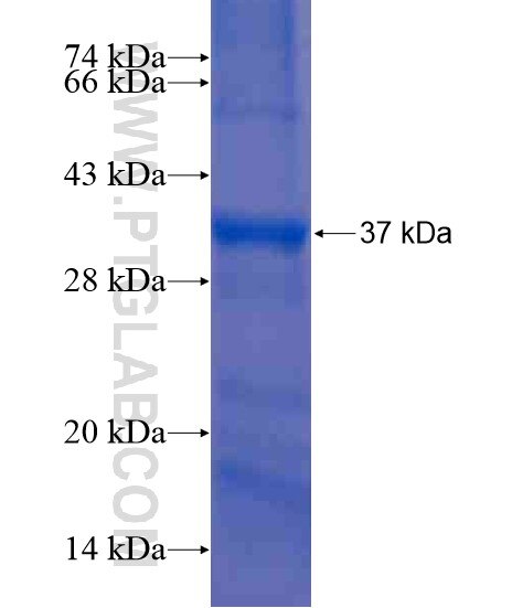 CFHR2 fusion protein Ag21106 SDS-PAGE
