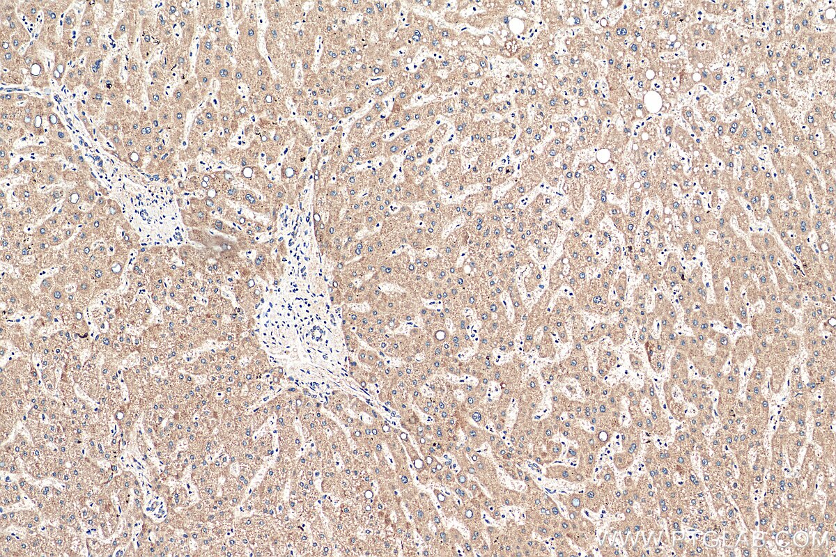 Immunohistochemistry (IHC) staining of human liver tissue using CFHR3 Polyclonal antibody (16583-1-AP)