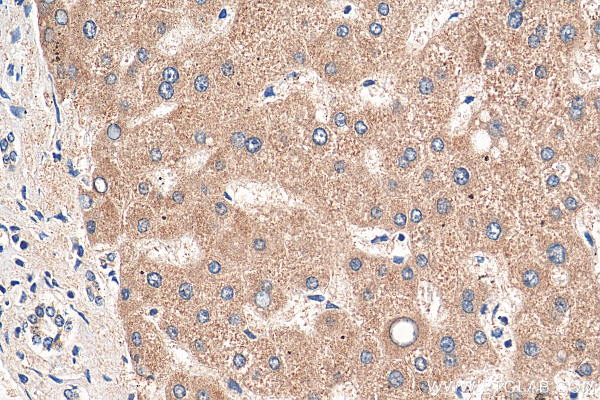 Immunohistochemistry (IHC) staining of human liver tissue using CFHR3 Polyclonal antibody (16583-1-AP)