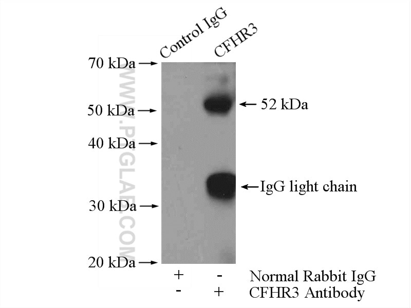 Immunoprecipitation (IP) experiment of HepG2 cells using CFHR3 Polyclonal antibody (16583-1-AP)
