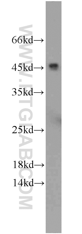 Western Blot (WB) analysis of human heart tissue using CFHR3 Polyclonal antibody (16583-1-AP)