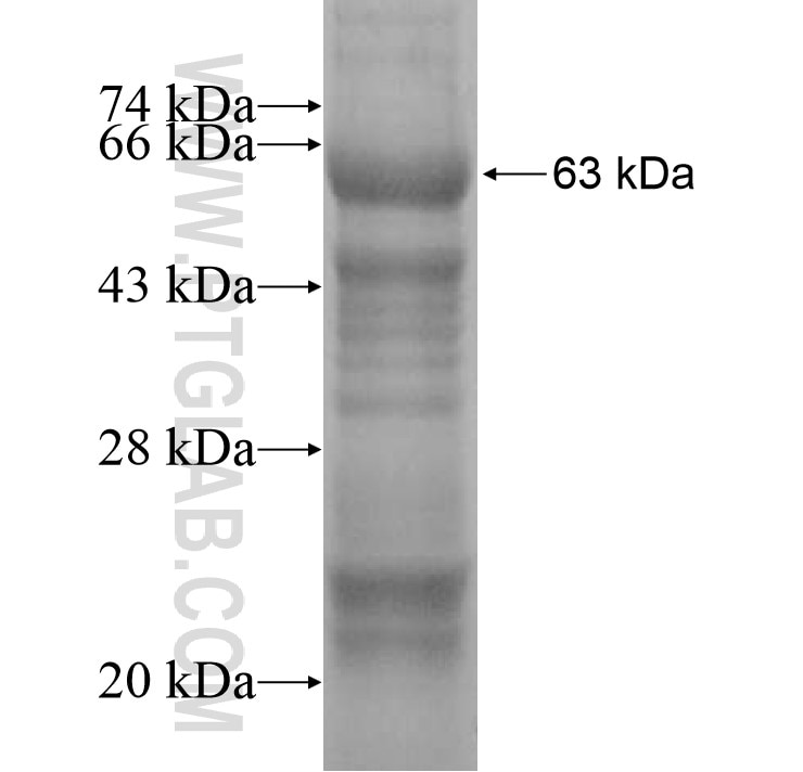 CFHR3 fusion protein Ag9963 SDS-PAGE
