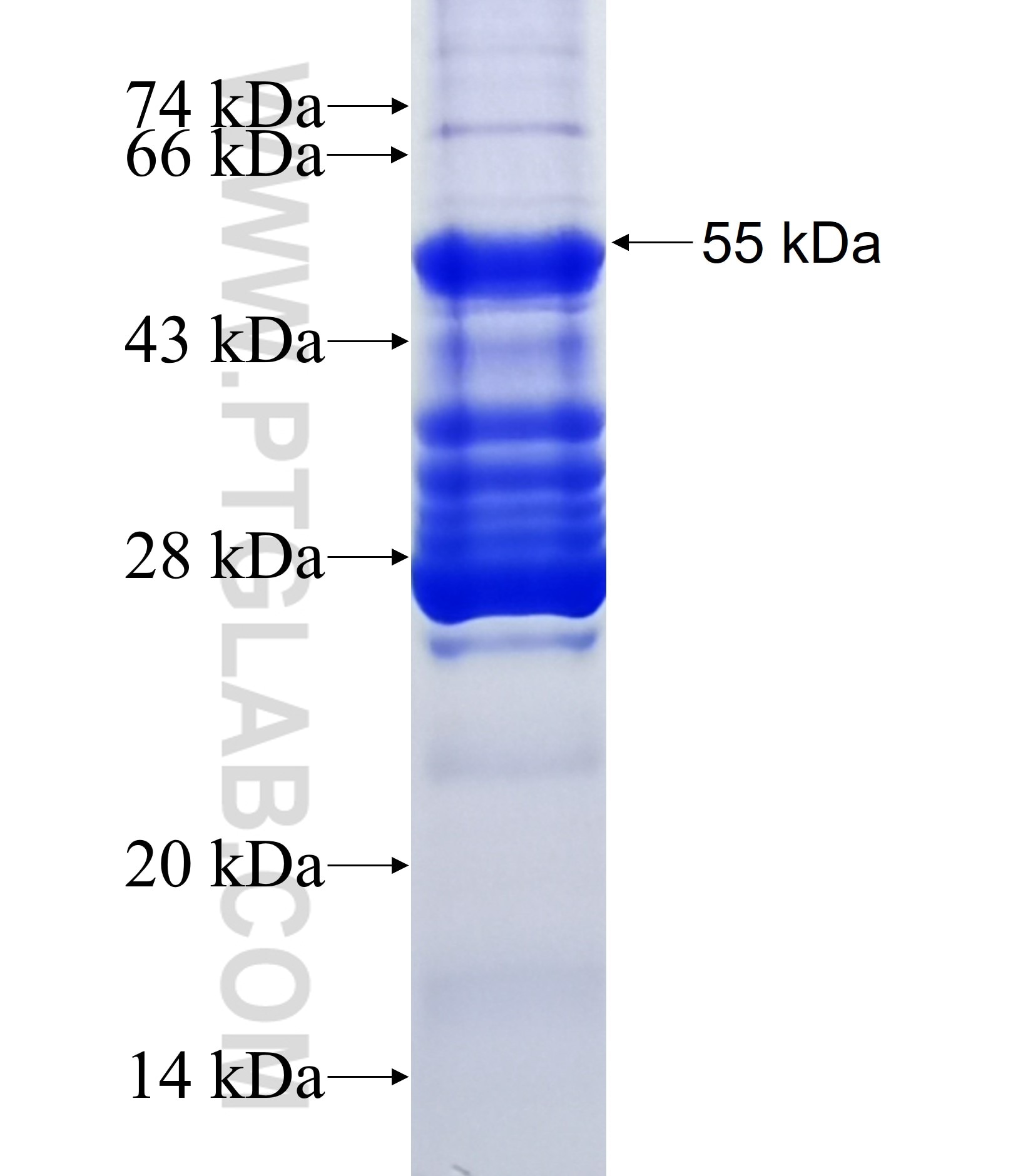 CFI fusion protein Ag37396 SDS-PAGE