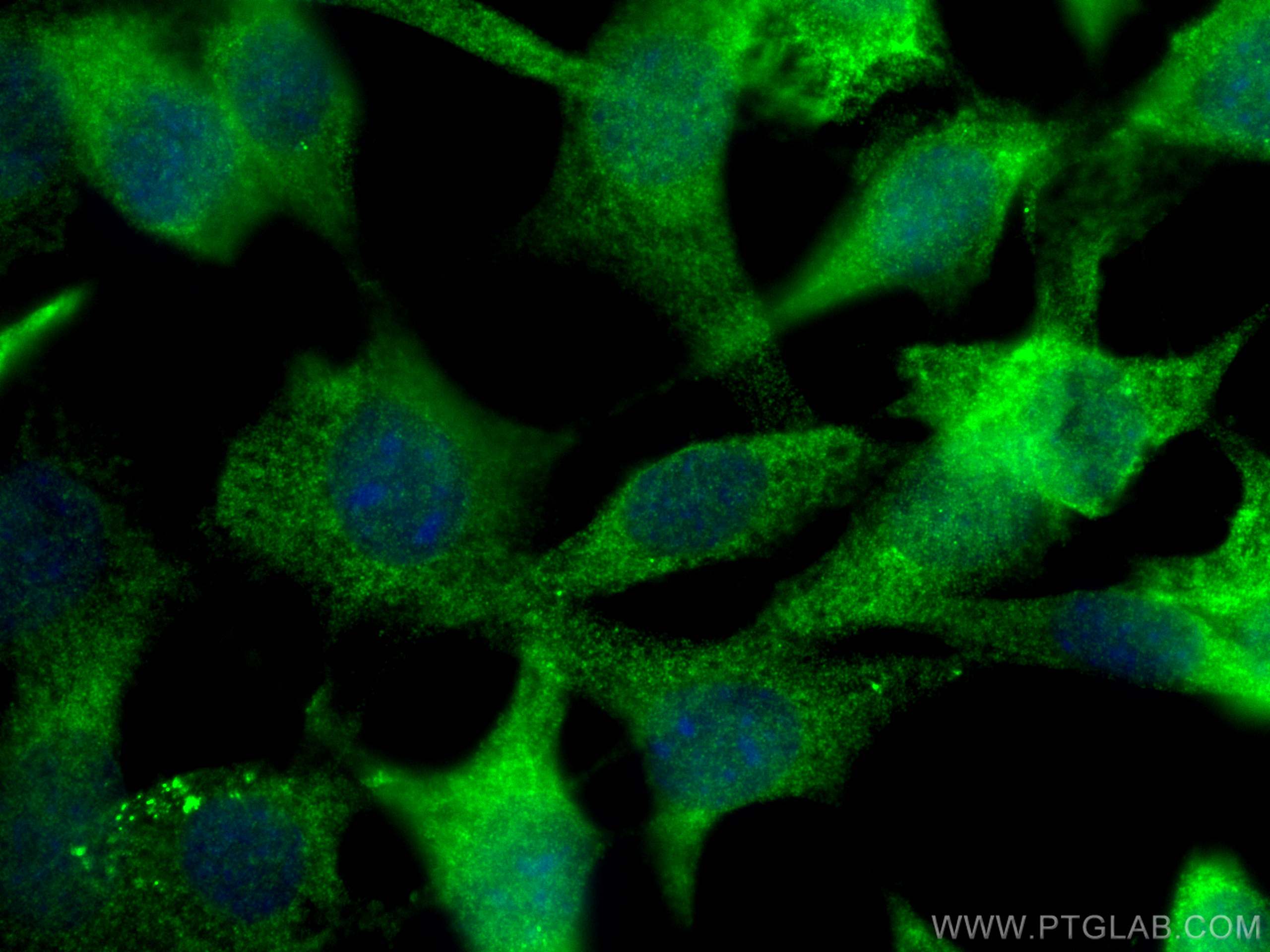 Immunofluorescence (IF) / fluorescent staining of NIH/3T3 cells using Cofilin Polyclonal antibody (10960-1-AP)