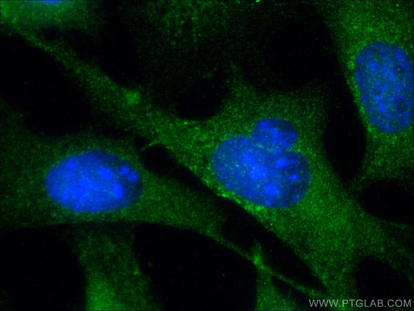 Immunofluorescence (IF) / fluorescent staining of NIH/3T3 cells using Cofilin Polyclonal antibody (10960-1-AP)