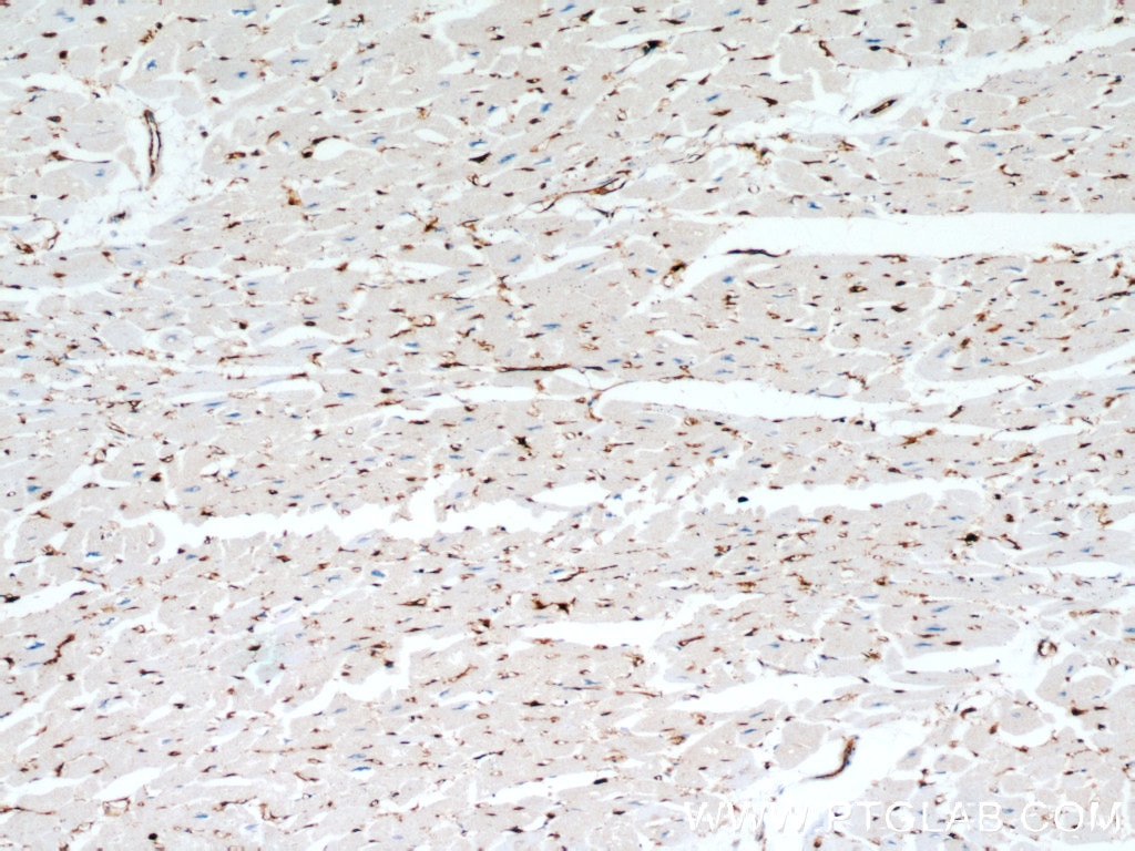 IHC staining of human heart using 10960-1-AP