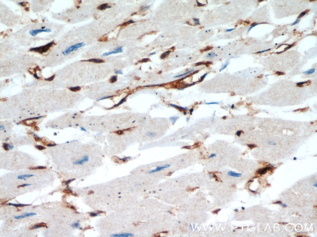 Immunohistochemistry (IHC) staining of human heart tissue using Cofilin Polyclonal antibody (10960-1-AP)