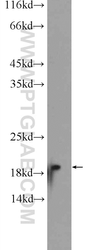 Western Blot (WB) analysis of rat brain tissue using Cofilin Polyclonal antibody (10960-1-AP)