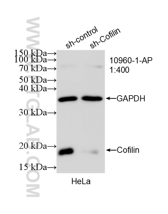 WB analysis of HeLa using 10960-1-AP Western Blot (WB) analysis of HeLa cells using Cofilin Polyclonal antibody (10960-1-AP)