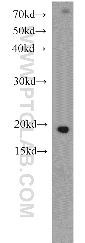 Western Blot (WB) analysis of MCF-7 cells using Cofilin Polyclonal antibody (10960-1-AP)
