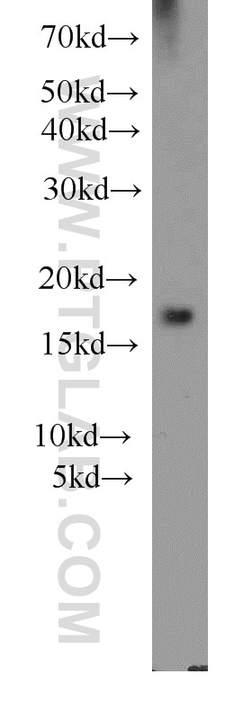 Western Blot (WB) analysis of mouse brain tissue using Cofilin Polyclonal antibody (10960-1-AP)