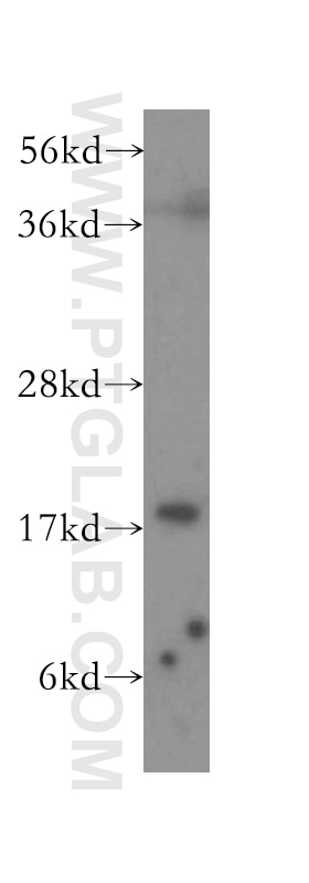 Western Blot (WB) analysis of human skin tissue using Cofilin Polyclonal antibody (10960-1-AP)