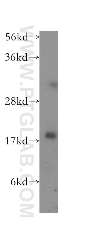 Western Blot (WB) analysis of human brain tissue using Cofilin Polyclonal antibody (10960-1-AP)