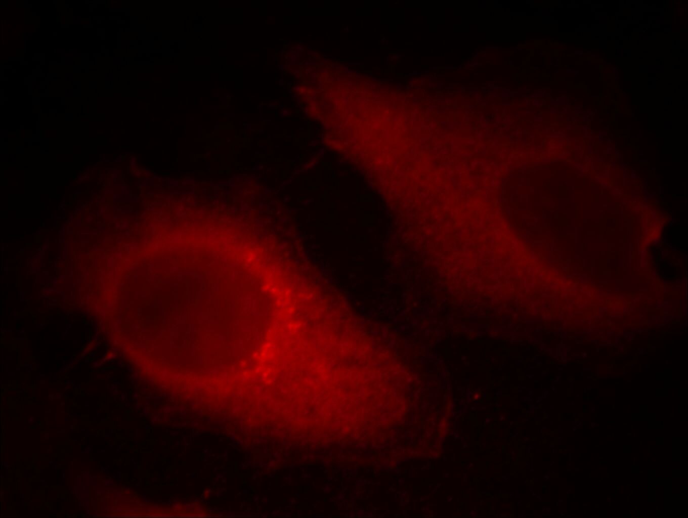 Immunofluorescence (IF) / fluorescent staining of HeLa cells using Cofilin Monoclonal antibody (66057-1-Ig)