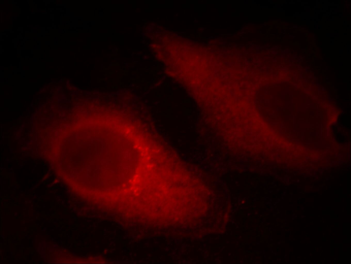 IF Staining of HeLa using 66057-1-Ig