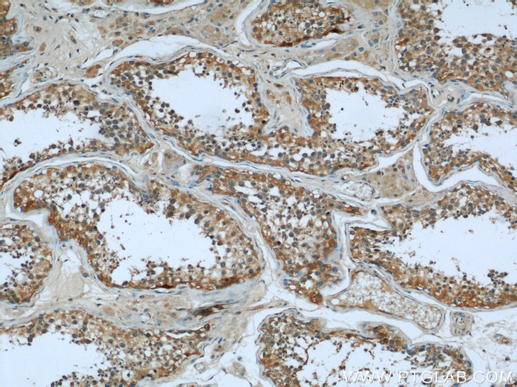 Immunohistochemistry (IHC) staining of human testis tissue using Cofilin Monoclonal antibody (66057-1-Ig)