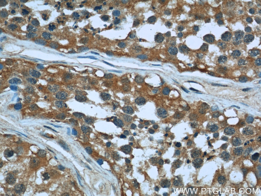 Immunohistochemistry (IHC) staining of human testis tissue using Cofilin Monoclonal antibody (66057-1-Ig)