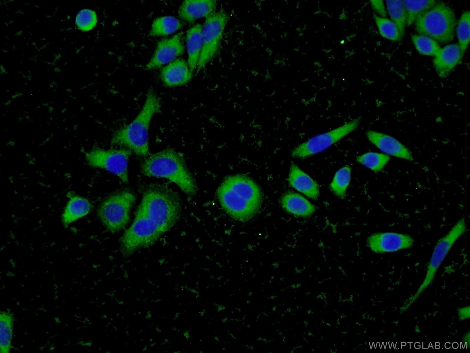 Immunofluorescence (IF) / fluorescent staining of L02 cells using Cofilin 2 Polyclonal antibody (11848-1-AP)
