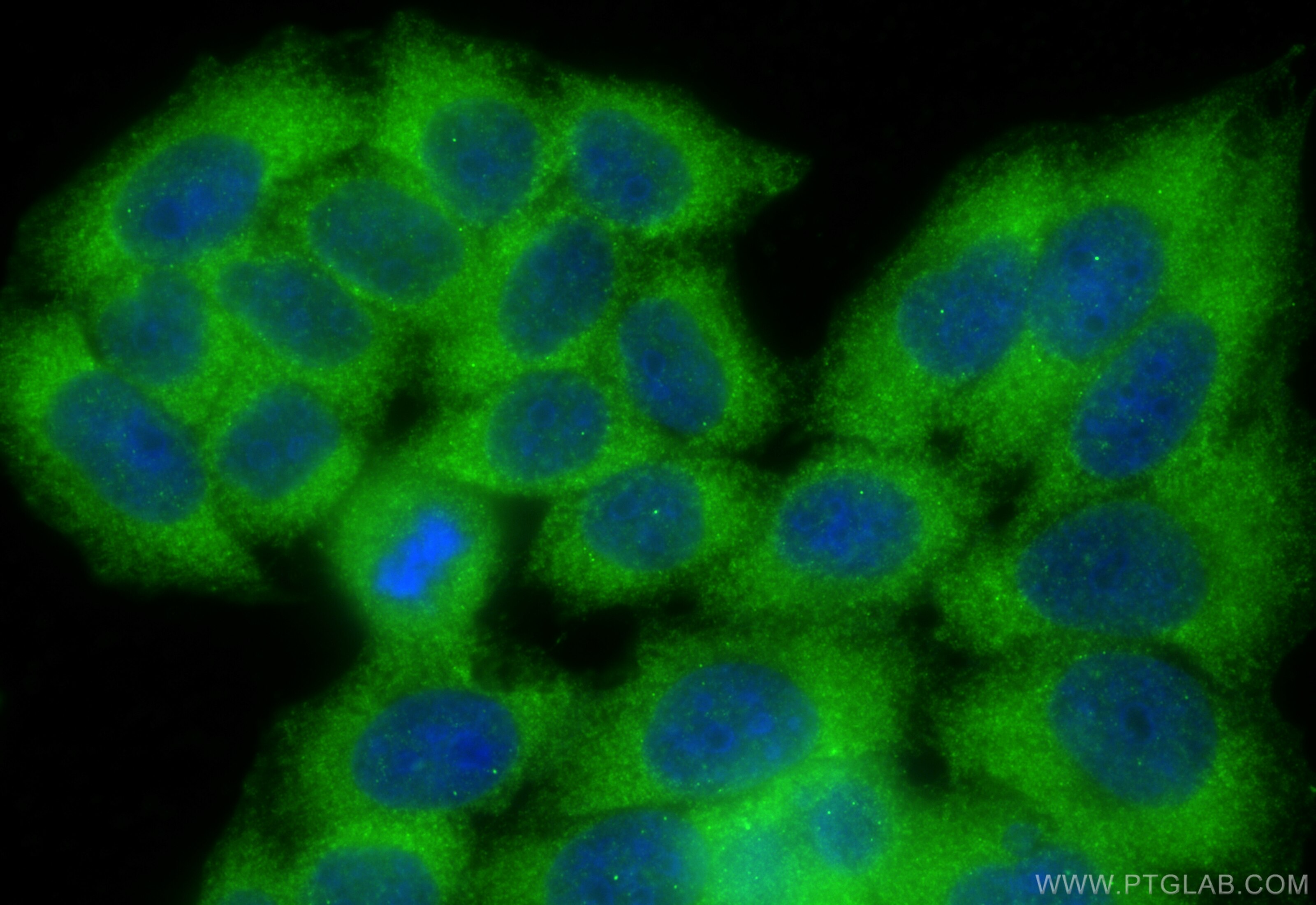 Immunofluorescence (IF) / fluorescent staining of L02 cells using Cofilin 2 Polyclonal antibody (11848-1-AP)