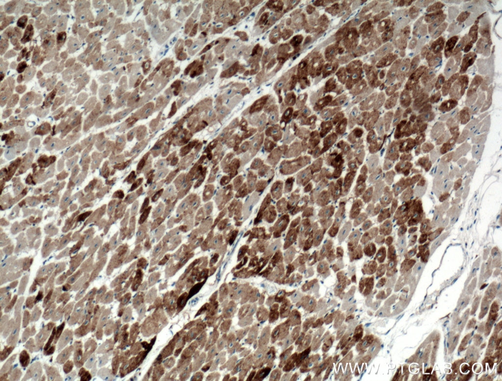Immunohistochemistry (IHC) staining of human heart tissue using Cofilin 2 Polyclonal antibody (11848-1-AP)