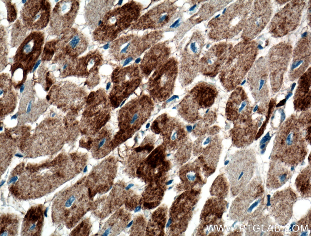 IHC staining of human heart using 11848-1-AP
