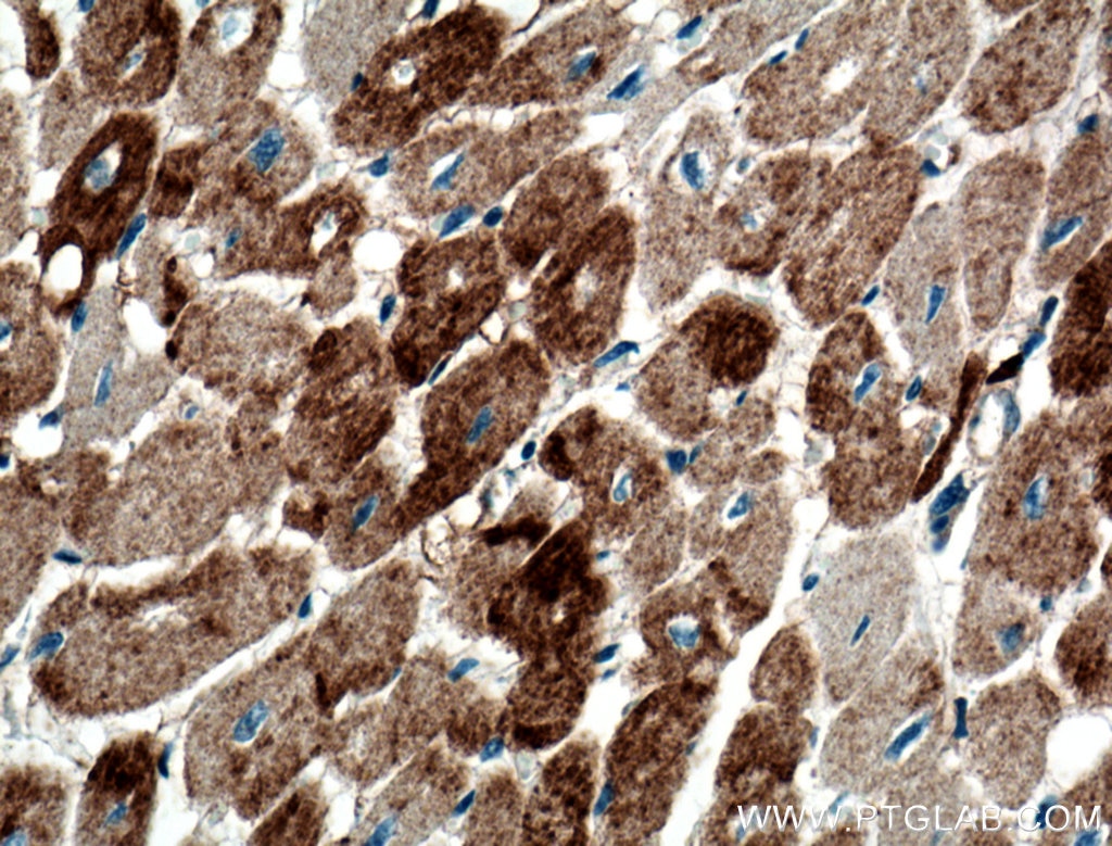 Immunohistochemistry (IHC) staining of human heart tissue using Cofilin 2 Polyclonal antibody (11848-1-AP)