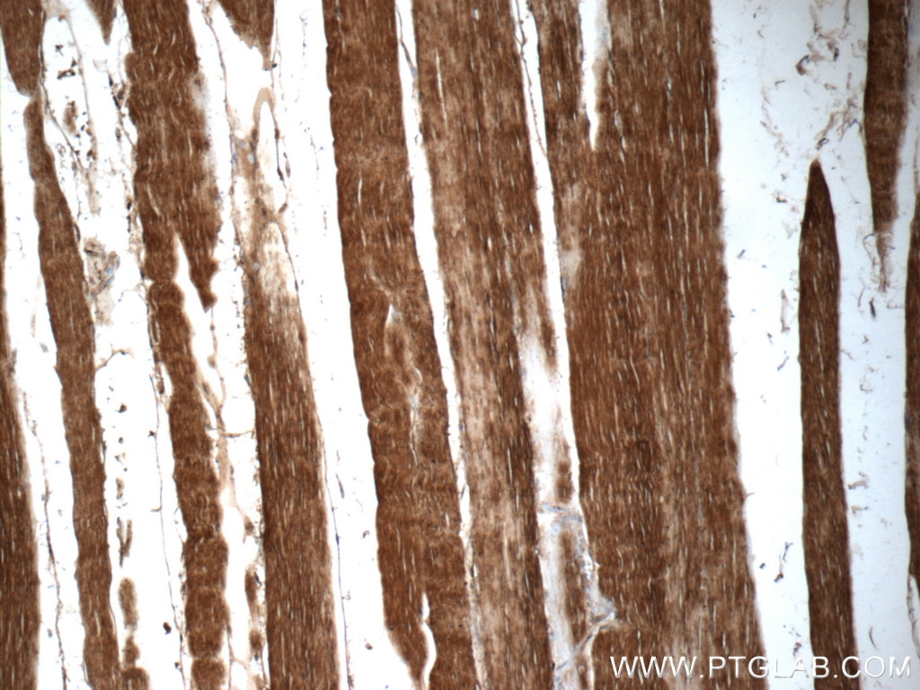 Immunohistochemistry (IHC) staining of human skeletal muscle tissue using Cofilin 2 Polyclonal antibody (11848-1-AP)
