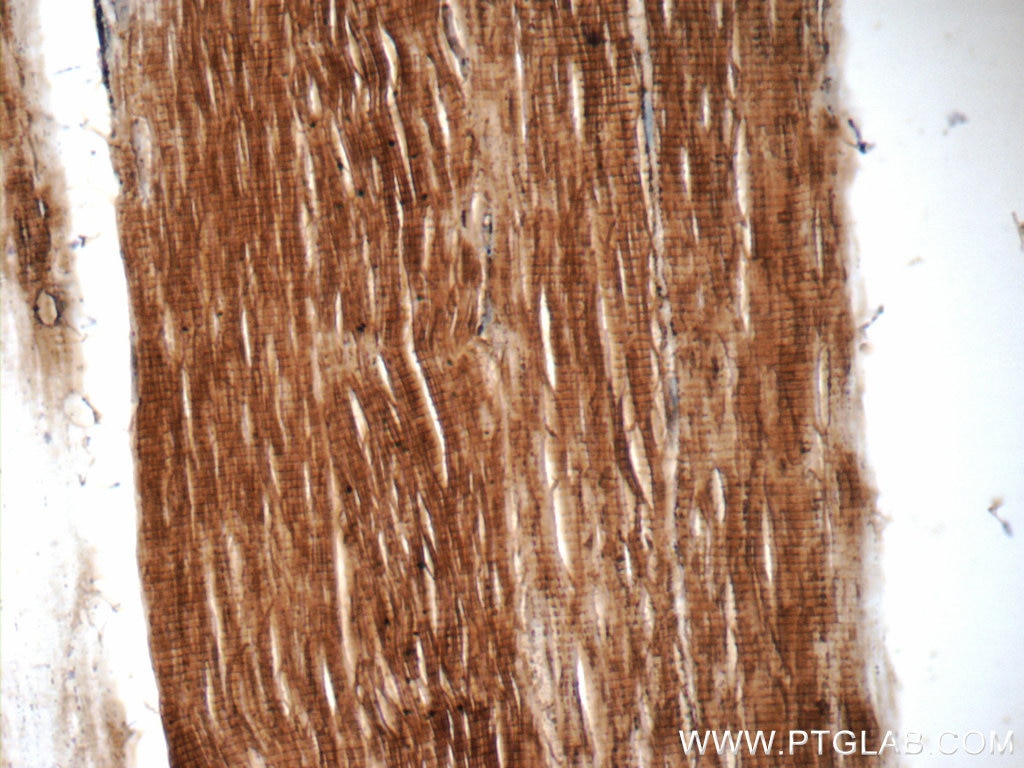 Immunohistochemistry (IHC) staining of human skeletal muscle tissue using Cofilin 2 Polyclonal antibody (11848-1-AP)