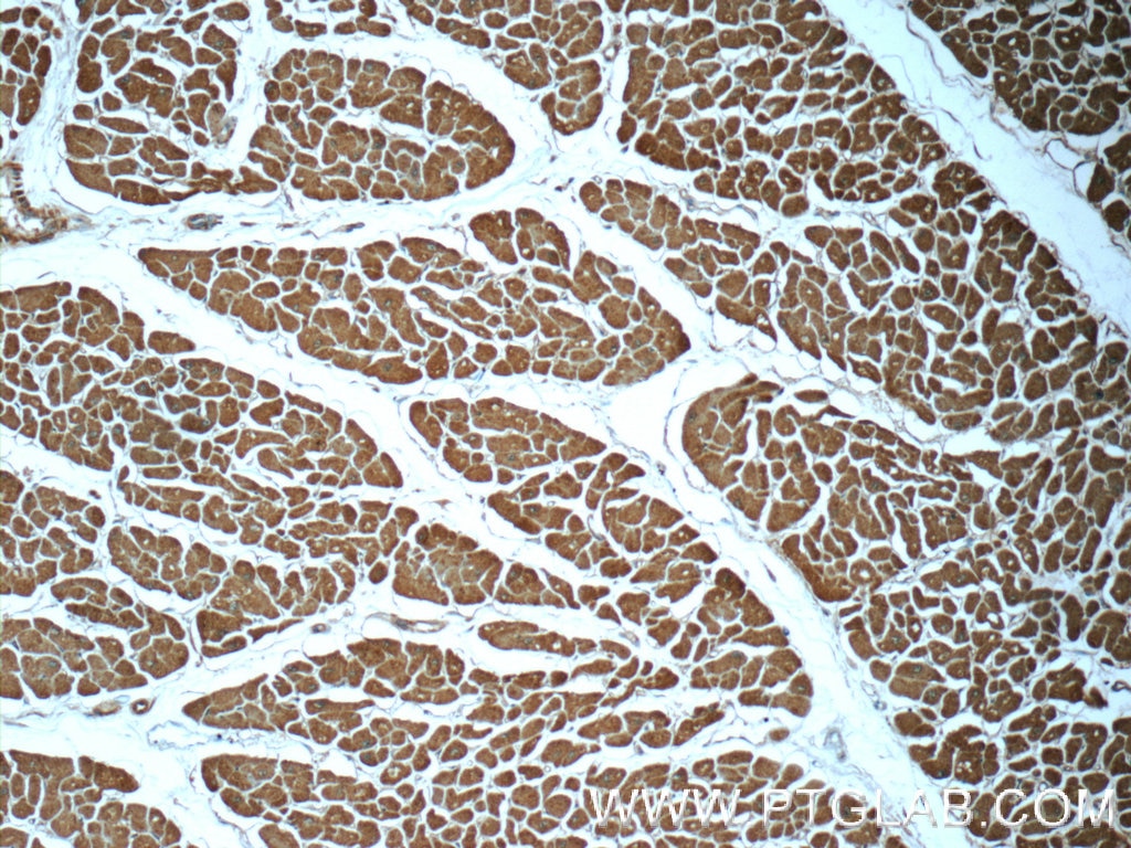 Immunohistochemistry (IHC) staining of human heart tissue using Cofilin 2 Polyclonal antibody (11848-1-AP)