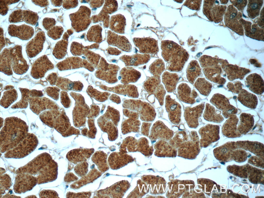 Immunohistochemistry (IHC) staining of human heart tissue using Cofilin 2 Polyclonal antibody (11848-1-AP)