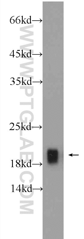 Western Blot (WB) analysis of mouse skeletal muscle tissue using Cofilin 2 Polyclonal antibody (11848-1-AP)