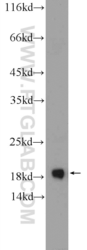 Western Blot (WB) analysis of mouse lung tissue using Cofilin 2 Polyclonal antibody (11848-1-AP)