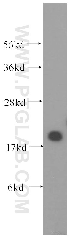 Western Blot (WB) analysis of human liver tissue using Cofilin 2 Polyclonal antibody (11848-1-AP)