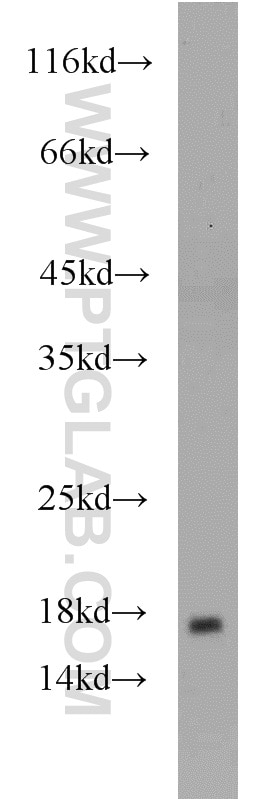 Western Blot (WB) analysis of human liver tissue using Cofilin 2 Polyclonal antibody (11848-1-AP)