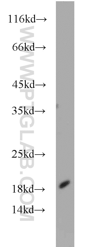 WB analysis of L02 using 11848-1-AP