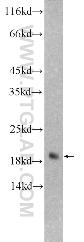 Western Blot (WB) analysis of mouse skeletal muscle tissue using Cofilin 2 Polyclonal antibody (11848-1-AP)