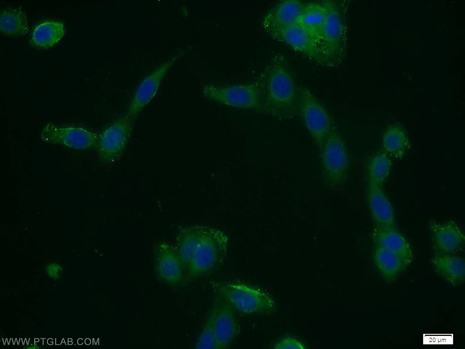 Immunofluorescence (IF) / fluorescent staining of HeLa cells using CFLAR/FLIP Polyclonal antibody (10394-1-AP)