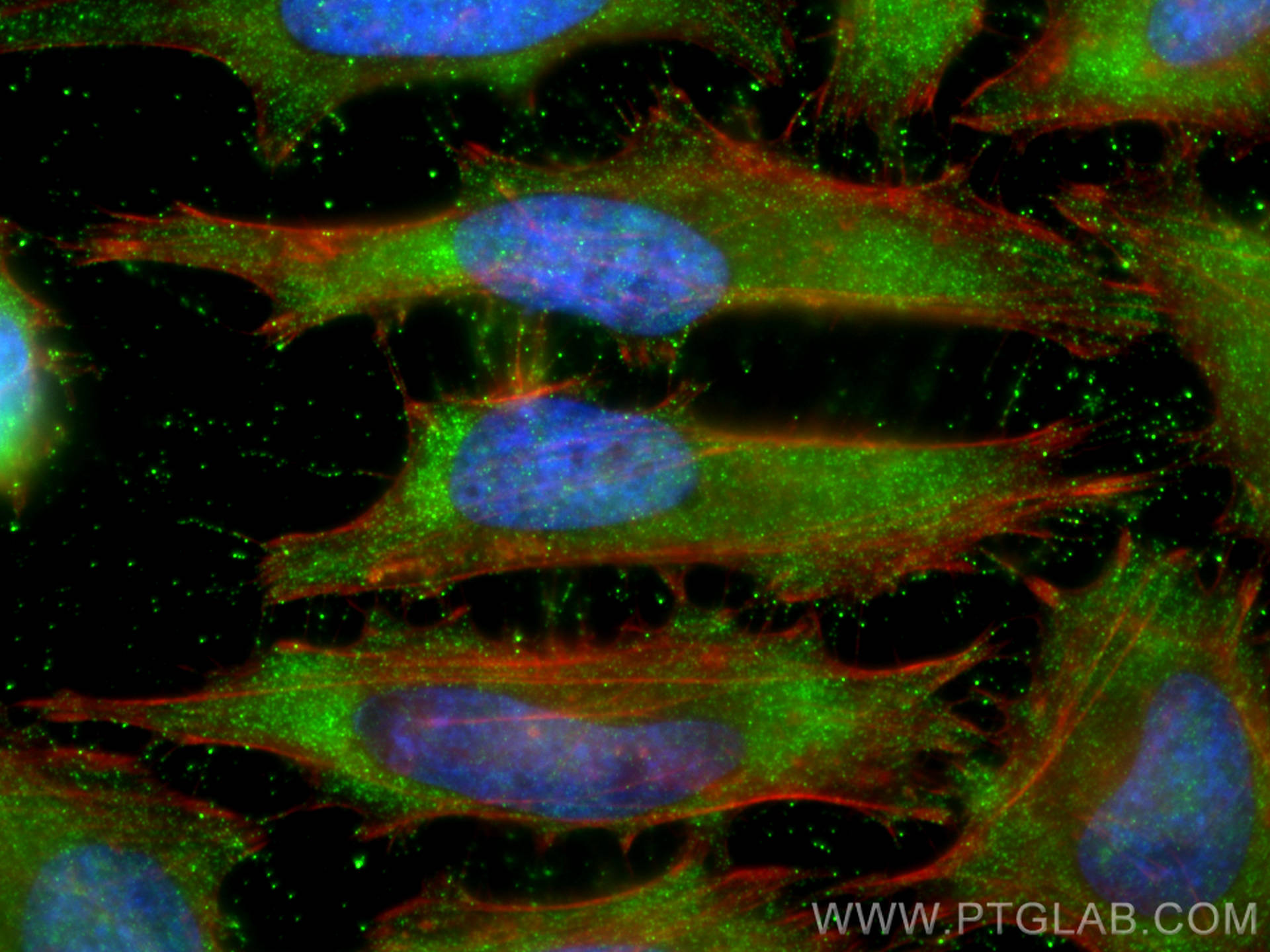 Immunofluorescence (IF) / fluorescent staining of HeLa cells using CFLAR/FLIP Polyclonal antibody (10394-1-AP)