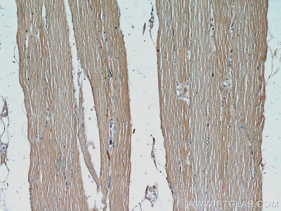 Immunohistochemistry (IHC) staining of human skeletal muscle tissue using CFLAR/FLIP Polyclonal antibody (10394-1-AP)