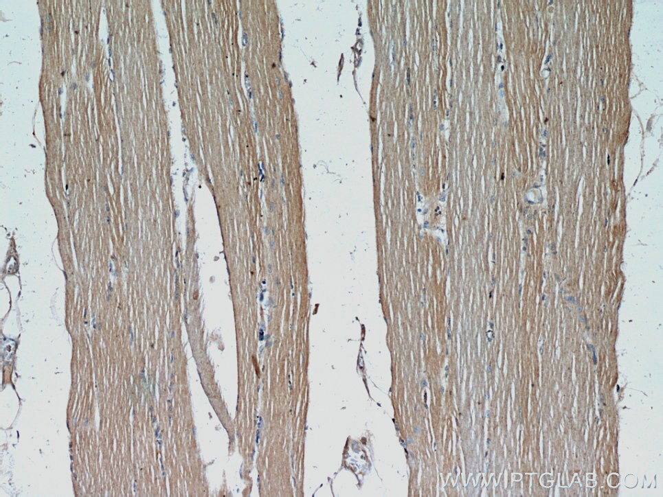 Immunohistochemistry (IHC) staining of human skeletal muscle tissue using CFLAR/FLIP Polyclonal antibody (10394-1-AP)